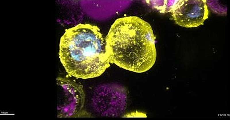 When cells go boom: study reveals inflammation-causing gene carried by millions