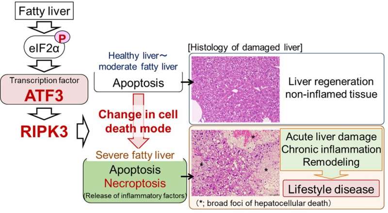Why severe fatty liver leads to liver damage