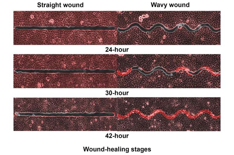 Why wavy wounds heal faster than straight wounds