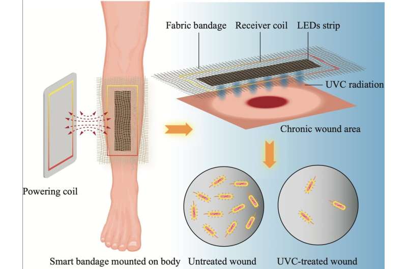 Wirelessly powered ‘smart bandage’ could provide drug-free wound care