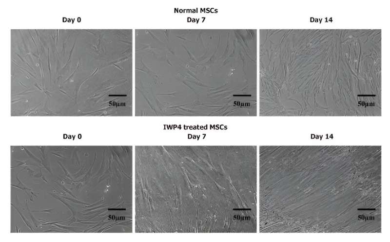 Wnt signaling pathway inhibitor promotes mesenchymal stem cell differentiation into cardiac progenitor cells