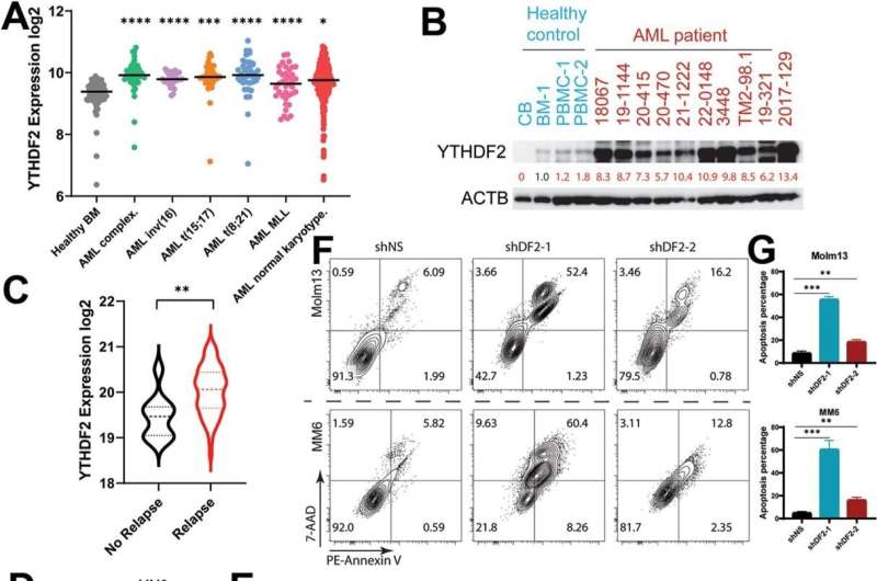 YTHDF2's role in promoting acute myeloid leukemia: The key lies in microRNA processing