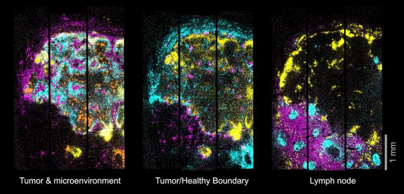 3D maps of diseased tissues at subcellular precision