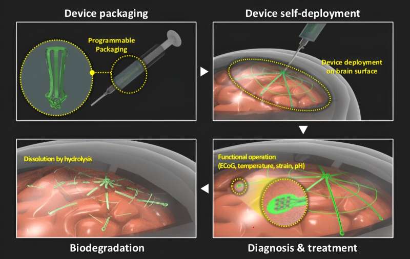 A biodegradable electronic tent electrode for medical diagnosis and brain-computer interfacing 