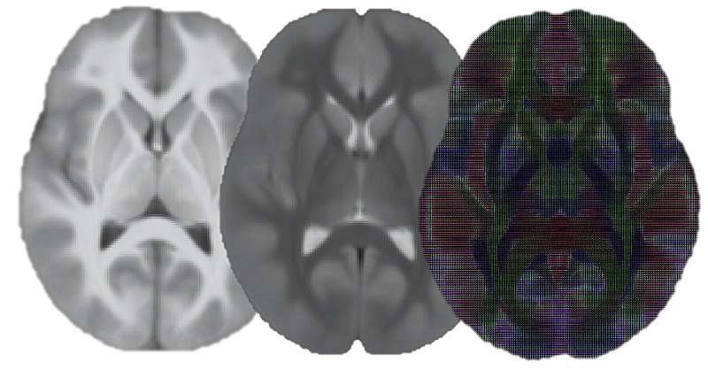 A new approach to neuroimaging analysis