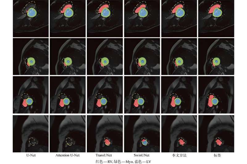 A new method for cardiac image segmentation