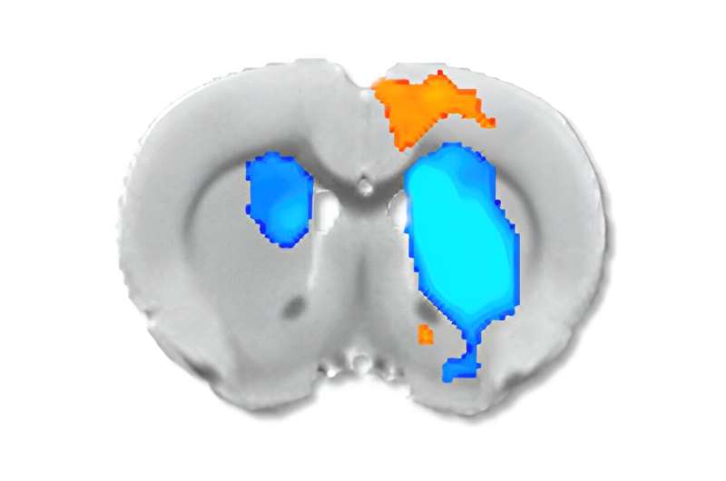 A new study shows how neurochemicals affect fMRI readings