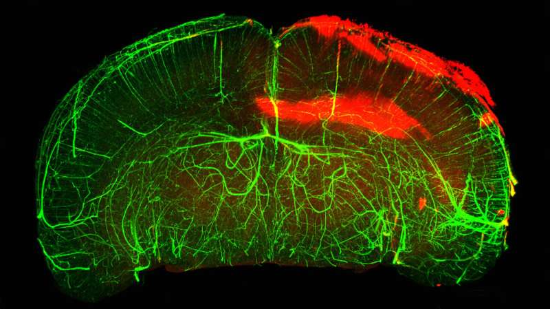 A new therapeutic target for traumatic brain injury