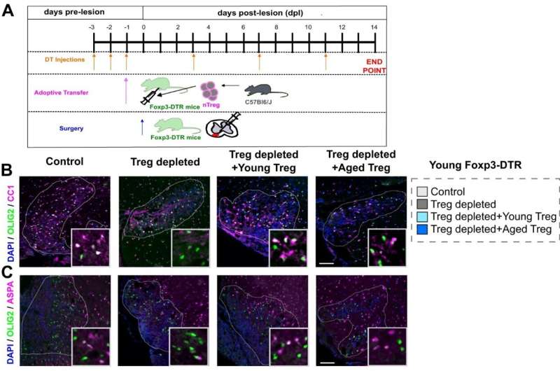 Aging reduces the ability of regulatory T cells to enhance myelin regeneration, study finds