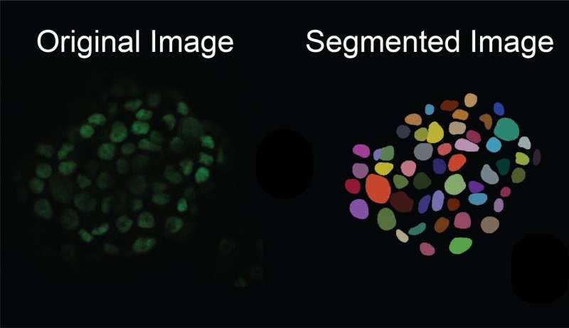 AI tool creates 'synthetic' images of cells for enhanced microscopy analysis