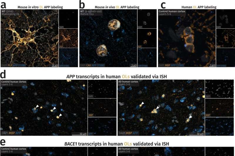 Alzheimer's disease: It's not only neurons—glial cells also produce harmful proteins