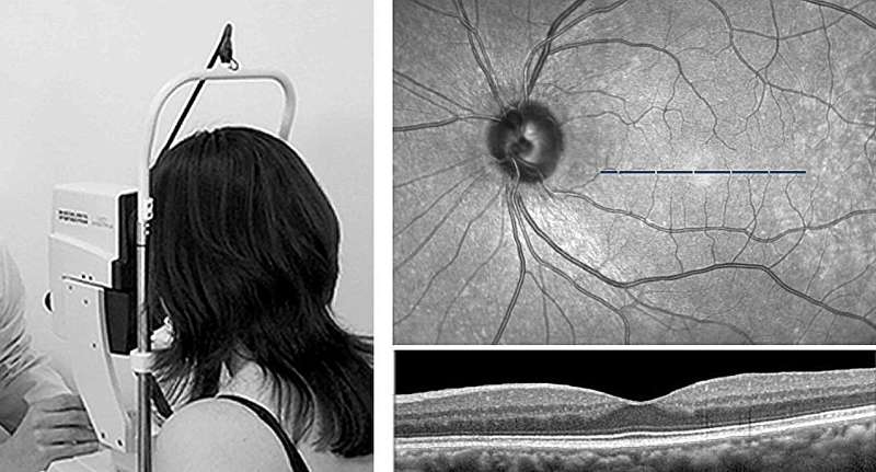 Analysing the progression in retinal thickness could predict cognitive progression in Parkinson's patients