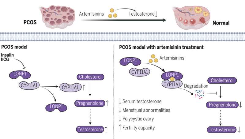 Antimalarial drug shows promise in treating PCOS in women