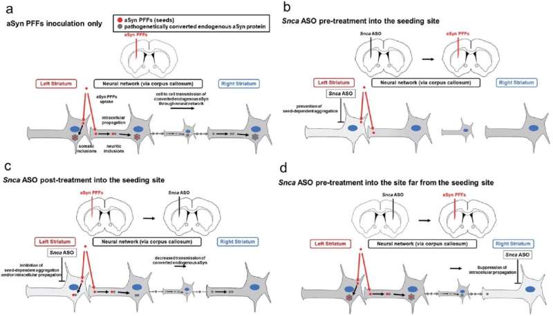 Antisense oligonucleotide treatment shows promise in treating Parkinson's disease progression
