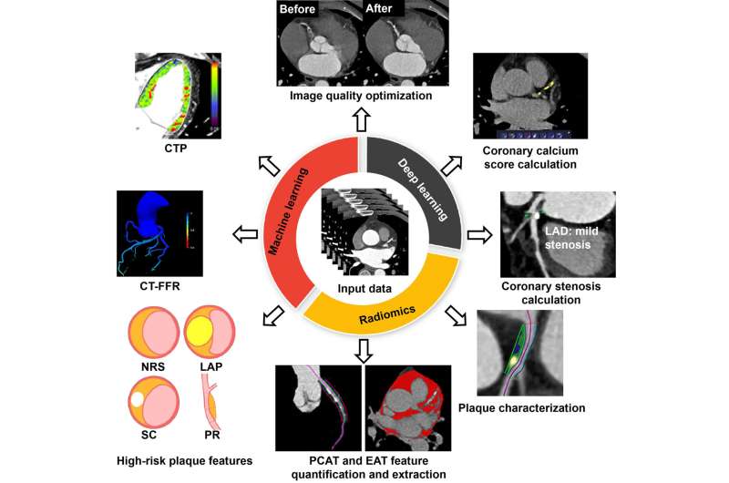 Artificial intelligence helps coronary CT angiography and accelerates the development of precision medicine