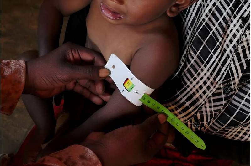At least 1.3 million people in Madagascar, one of the world's poorest countries, suffer from malnutrition, the UN says