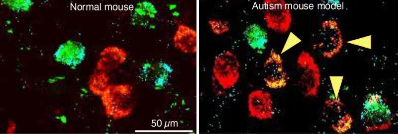 Autism spectrum disorders linked to neurotransmitter switching in the brain