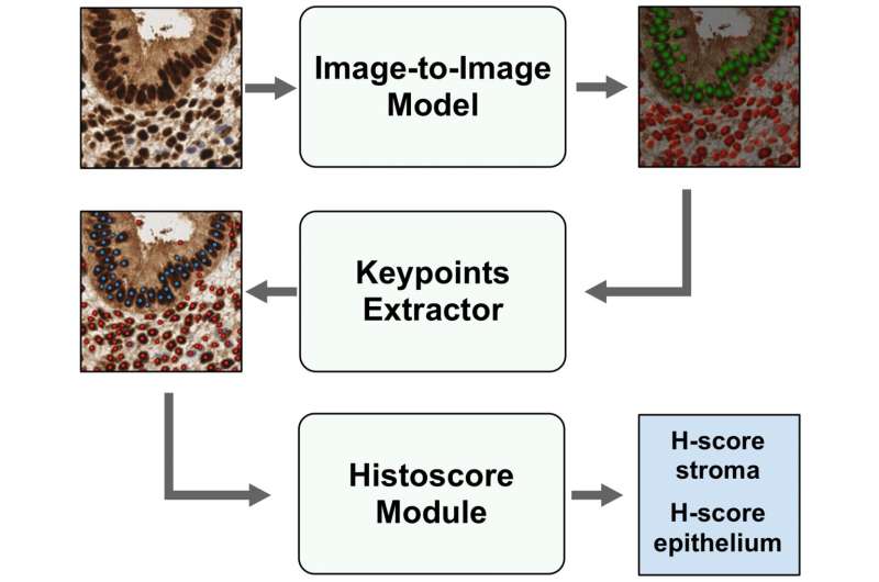 Automatic calculation of H-score on histological slides via artificial intelligence