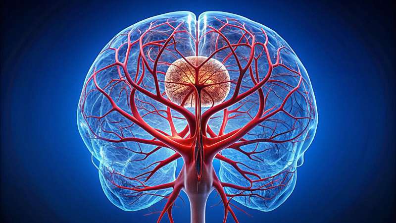 Balloon angioplasty lowers risk for composite outcome in intracranial artery stenosis