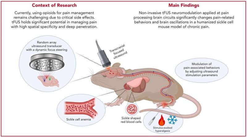 Battling chronic pain with noninvasive focused ultrasound  