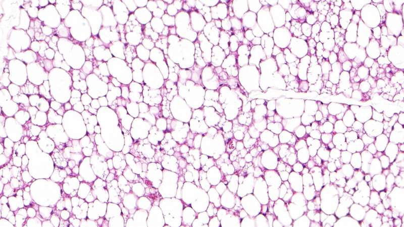 Beige fat cells with a Sisyphus mechanism