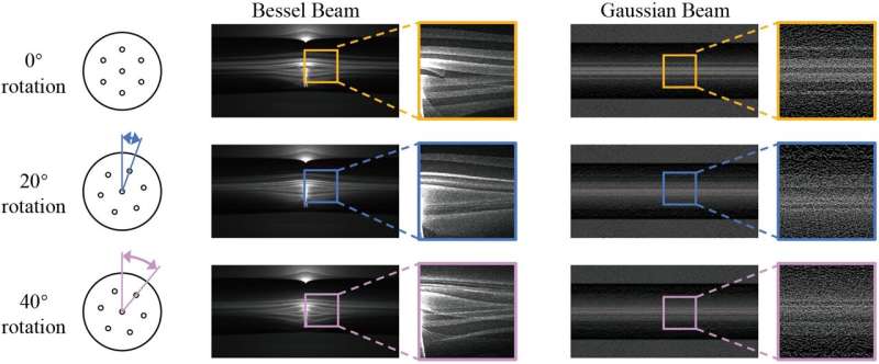 Bessel-beam-based side-view measurement of seven-core fiber internal core distribution