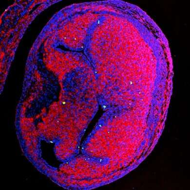 Biologists find nanoplastics in developing heart