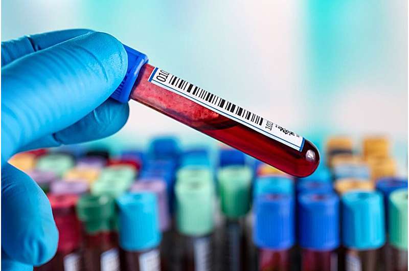 Blood test 91% accurate at predicting alzheimer's, outperforming doctors