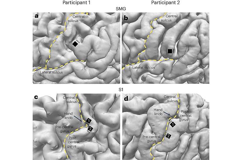 Brain-machine interface device predicts internal speech in second patient