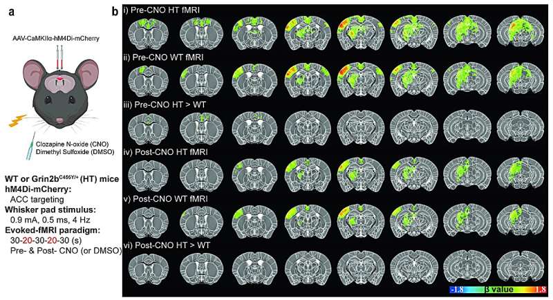 Brain mechanisms underlying sensory hypersensitivity in a mouse model of autism spectrum disorder