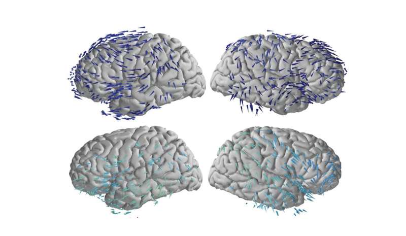 Brain waves travel in one direction when memories are made and the opposite when recalled