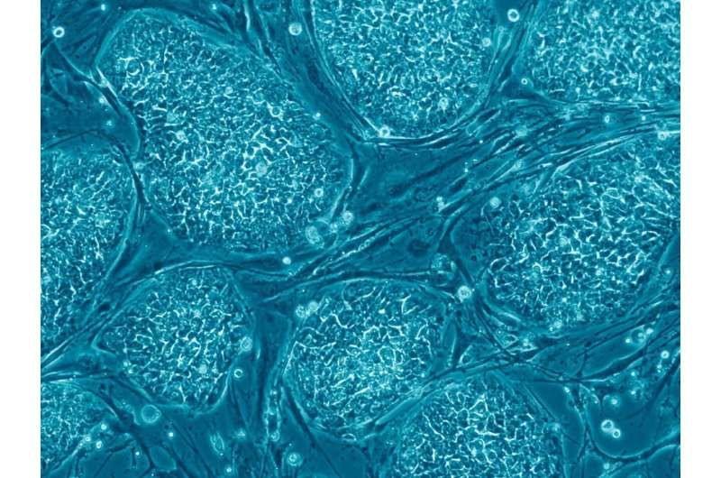 Cancer-related mutations appear in stem cell derivatives utilized in regenerative medicine