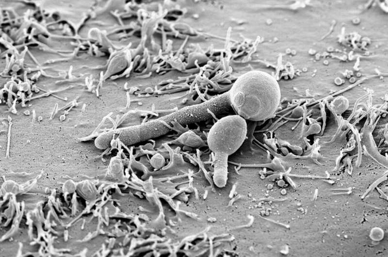 Candida albicans toxin plays a special role in the colonization of the digestive tract