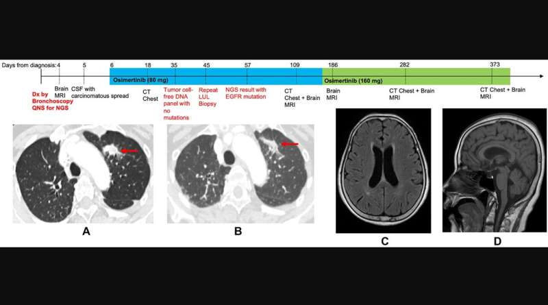 Case report: Lazarus effect in a patient treated with osimertinib for NSCLC with leptomeningeal disease
