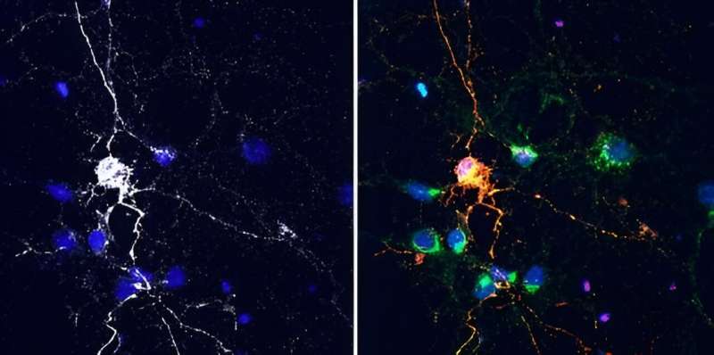 Cell surface protein is a biological target for immune therapies, Alzheimer's treatments, researchers find