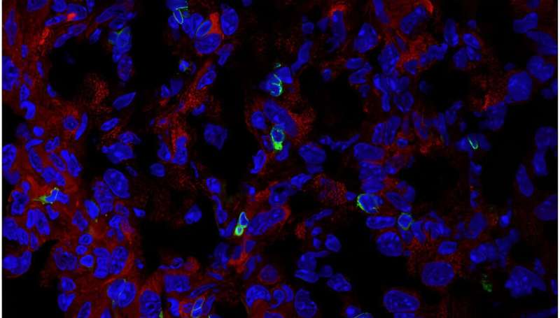 Checkpoint identified to fight solid tumors