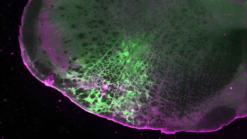 Chemical tool illuminates pathways used by dopamine, opioids and other neuronal signals