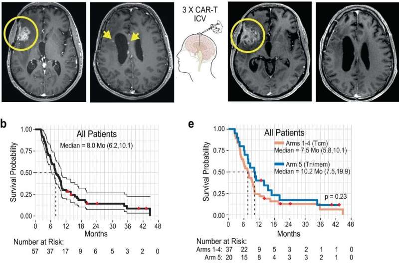 Chimeric antigen receptor (CAR) T cell therapy shows clinical activity in patients with aggressive brain tumors