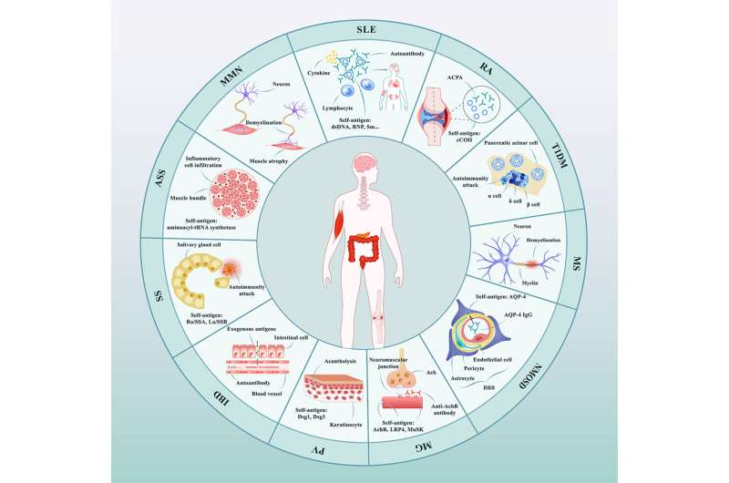 Chinese Medical Journal review article highlights the potential and promise of CAR-T cell therapy in autoimmune diseases
