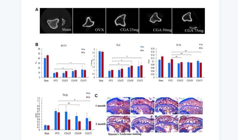 Chlorogenic acid prevents ovariectomized-induced bone loss by facilitating osteoblast functions and suppressing osteoclast formation