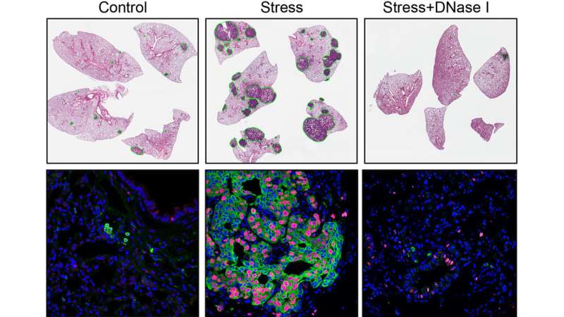 Chronic stress spreads cancer … here's how