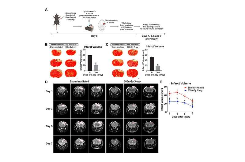 CityU neuroscientists uncover the therapeutic potential of low-dose ionizing radiation for traumatic brain injury and ischemic s