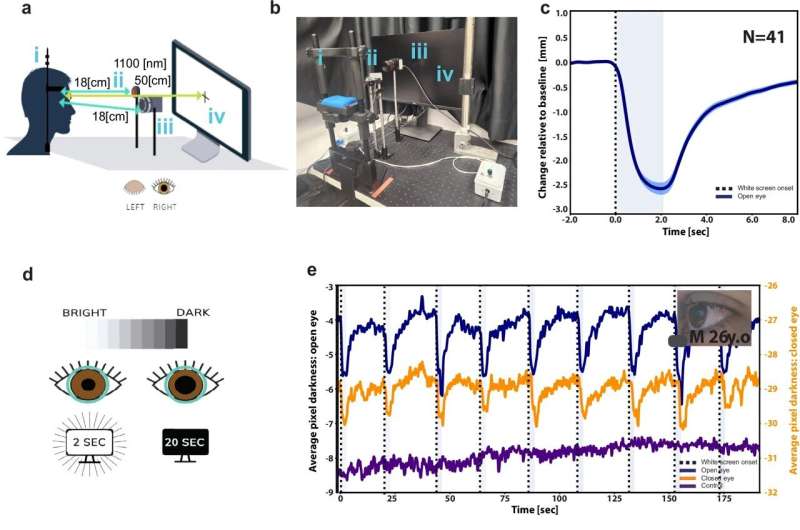 Closed-eye imaging can track wakefulness, awareness, and pain in unresponsive conditions