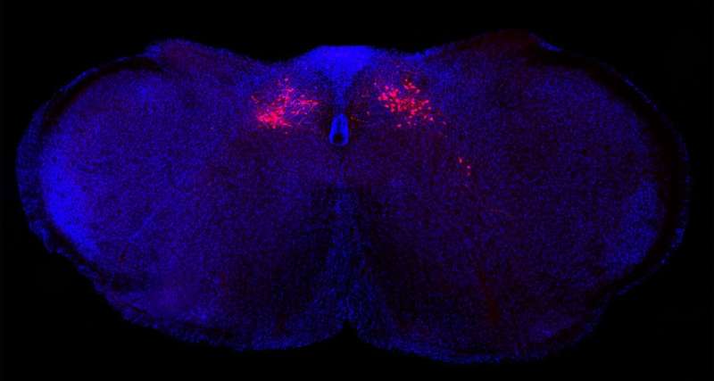 Columbia scientists identify new brain circuit in mice that controls body's inflammatory reactions