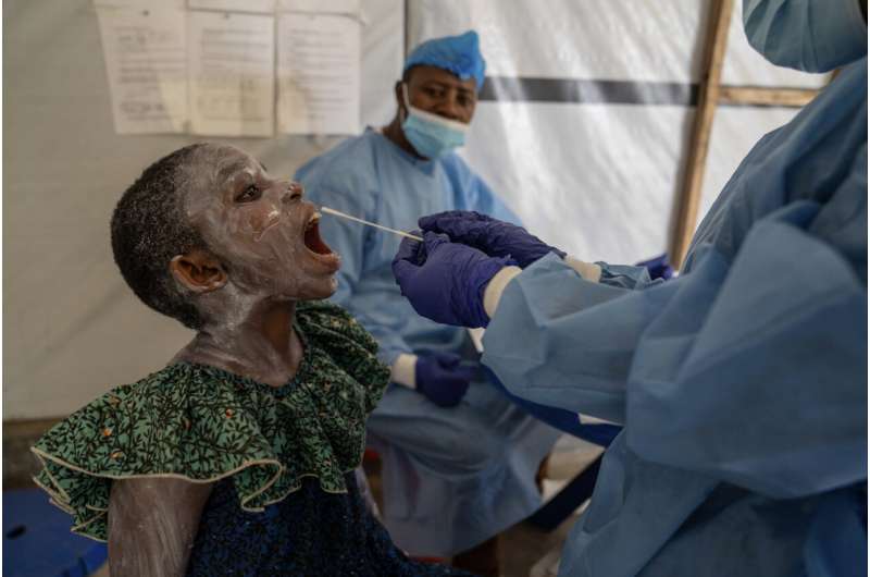 La crisis humanitaria del Congo contribuyó a que el mpox volviera a caer en una emergencia sanitaria mundial