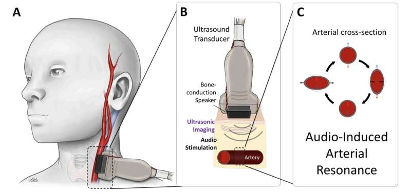 Continuous, noninvasive blood pressure monitoring using sound