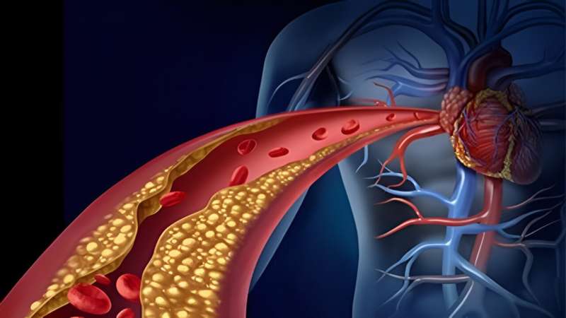 Coronary artery disease testing after initial heart failure hospitalization aids outcomes