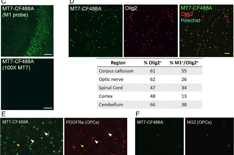 A brand new drug may flip again the clock on more than one sclerosis