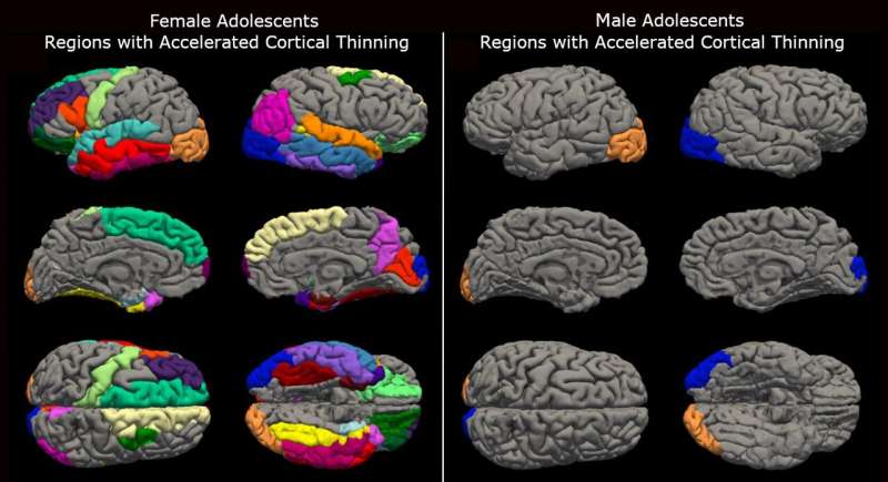 COVID-19 lockdowns prematurely aged teenage brains, UW study shows