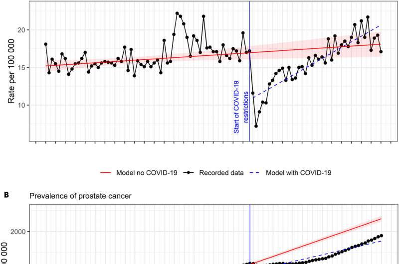 COVID-19 pandemic could have led to 20,000 prostate cancer diagnosis being missed